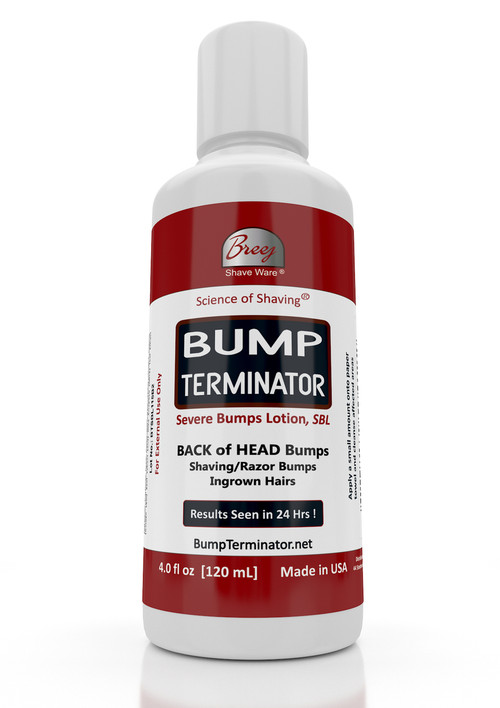 For Fast Relief of Severe Shaving Bumps, Ingrown Hairs and Back of the Head Bumps

BUMP TERMINATOR Severe Bumps Lotion is a Fast Acting formula with very effective natural healing oils - lavender, patchouli, tea tree; extracts of gotu kola and willowbark plus glycolic acid, salicylic acid and alpha bisabolol. This advanced and Fast Acting BUMP TERMINATOR Severe Bumps Lotion is formulated with BREEJ Advanced Anti Bump Phytoplex for the fast relief of Back of the Head Bumps.

DIRECTIONS FOR USE

Gently Cleanse Affected Areas With The Bump Terminator Severe Bumps Lotion Using “Bounty” Type Paper Towel.

NOTE: Product Is For Severe Shaving Bumps, Ingrown Hairs and Back of the Head Bumps.

For People With Sensitive Skin We Offer Our BUMP ZAPPER Severe Bumps Kit.

Alternatively, You Can Dilute The BUMP TERMINATOR Severe Bumps Lotion With An Equal Volume Of Water At Time Of Use

CAUTION: Discontinue use if irritation occurs