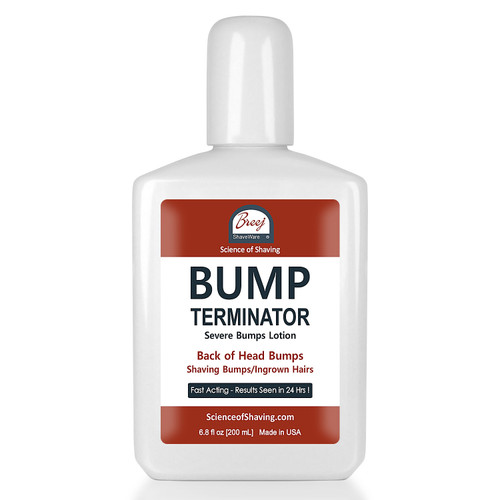 For Fast Relief of Severe Shaving Bumps, Ingrown Hairs and Back of the Head Bumps

BUMP TERMINATOR Severe Bumps Lotion is a Fast Acting formula with very effective natural healing oils - lavender, patchouli, tea tree; extracts of gotu kola and willowbark plus glycolic acid, salicylic acid and alpha bisabolol. This advanced and Fast Acting BUMP TERMINATOR Severe Bumps Lotion is formulated with BREEJ Advanced Anti Bump Phytoplex for the fast relief of Back of the Head Bumps.

DIRECTIONS FOR USE

Gently Cleanse Affected Areas With The Bump Terminator Severe Bumps Lotion Using “Bounty” Type Paper Towel.

NOTE: Product Is For Severe Shaving Bumps, Ingrown Hairs and Back of the Head Bumps.

For People With Sensitive Skin We Offer Our BUMP ZAPPER Severe Bumps Kit.

Alternatively, You Can Dilute The BUMP TERMINATOR Severe Bumps Lotion With An Equal Volume Of Water At Time Of Use

CAUTION: Discontinue use if irritation occurs