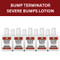 Experience Visible Improvements Within Just 24 Hours With Bump Terminator Severe Bumps Lotion. The Fast-Acting Formula, Enriched With Natural Healing Oils, Ensures You See A Difference Quickly.