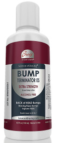 BUMP TERMINATOR ALCOHOL FREE Extra Strength Severe Bumps Lotion for Severe Back of Head Bumps is a NON-STINGING and NON-IRRITATING Fast Acting, formulated with very effective natural extracts - Centella Asiatica , Cucumis Sativus, Harpagophytum Procumbens, Lagerstroemia Speciosa, Forsythia Suspensa, Saururus Chinensis, Morus Alba, Alteromonas Ferment, Vincetoxicum Atratum, Eperua Falcata, Yucca Schidigera. This advanced and fast acting Bump Terminator ALCOHOL FREE Extra Strength Severe Bumps Lotion is formulated with BREEJ advanced anti bump alcohol free phytoplex for the fast relief of Severe Back of Head Bumps & Ingrown Hairs
