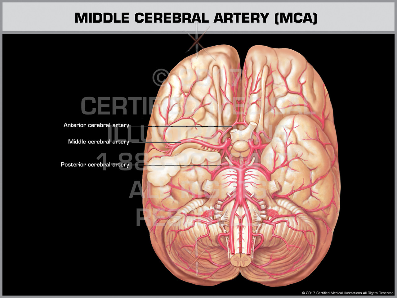 Middle Meningeal Artery Vs Middle Cerebral Artery Middle Cerebral Artery Segments Anatomy