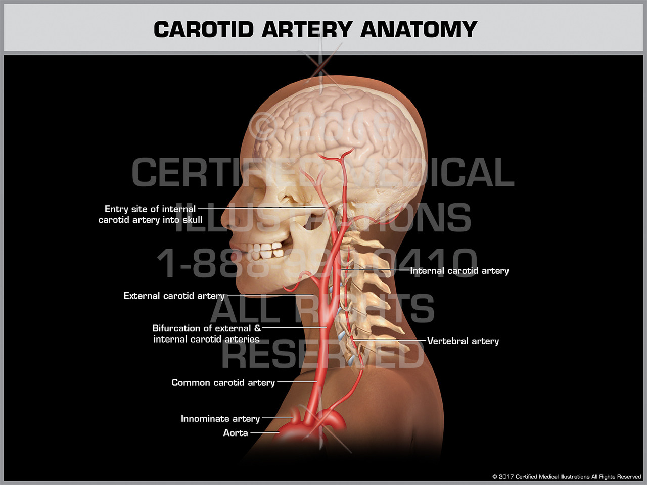 Carotid Artery Anatomy Print Quality Instant Download