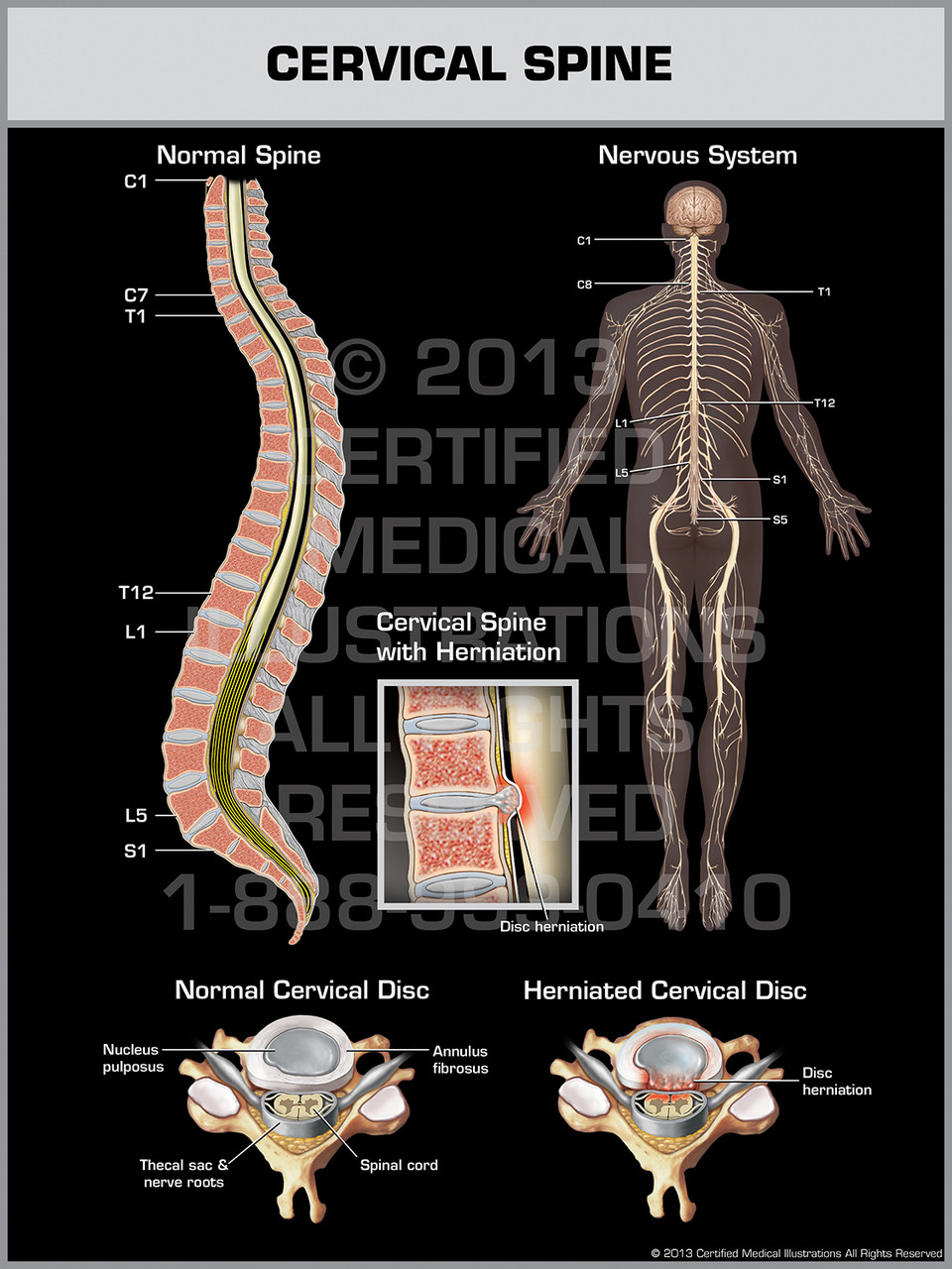Cervical Spine