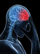 Relieve headaches with a sacroiliac belt
