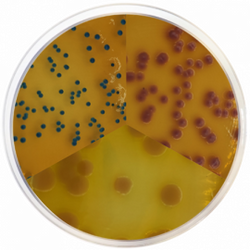 PEC Chromogenic Agar
