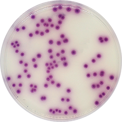 Salmonella Chromogenic Agar