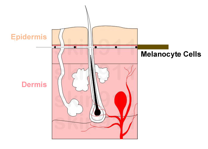 Brown Spots on Skin, Epidermis Melanocyte Cells