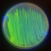 Genetic Design Starter Kit - Glowing Jellyfish Bacteria