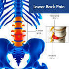 Lower-back pain icon