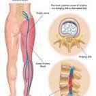 Sciatica icon