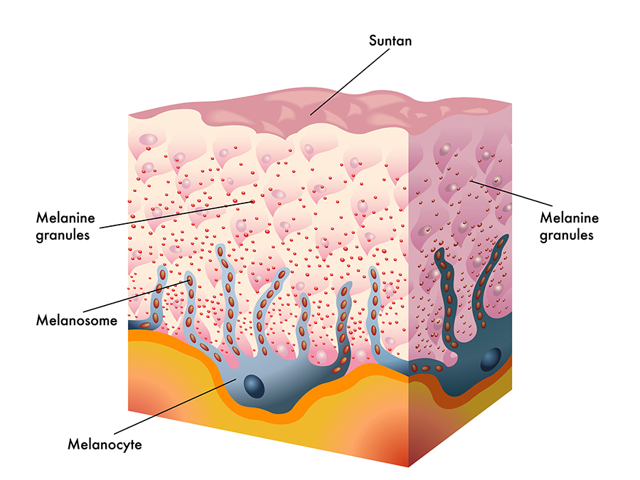 Пигмент меланин в каком слое. Клетки меланоциты в коже. Меланоциты эпидермиса кожи. Меланоциты меланин кожа. Пигмент меланин дерма.