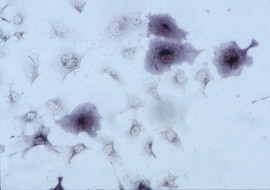 Visualization of IL-24 binding to its cell surface receptor. Cos cells transiently transfected with a heterodimeric IL-24 receptor were exposed to the IL-24-alkaline phosphatase fusion protein (IL-24-AP). The ligand bound to the cell surface of transfected cells was visualized by the alkaline phosphatase activity under a light microscope (20X magnification) without phase contrast.