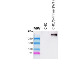 SARS-CoV-2 S2 Protein (Post-fusion) Binding Antibody, Mouse Monoclonal [MA152B-100 or MA152B-025]