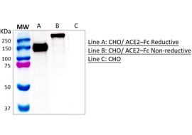 Human ACE2 Ecto domain Binding Antibody, Mouse Monoclonal [MA161B-100 or MA161B-025]