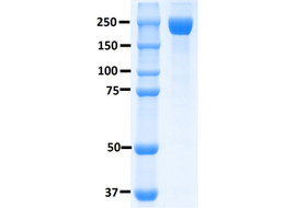 Recombinant SARS-CoV-2 S-Trimer Fusion Protein (WT)  [MP101-100 or MP101-025&91;