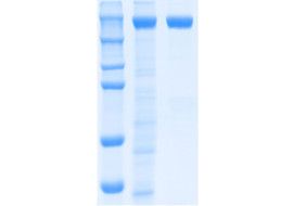 Recombinant SARS-CoV-2 S-Trimer Fusion Protein (Delta)  [MP103-100 or MP103-025]