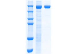Recombinant SARS-CoV-2 S-Trimer Fusion Protein (Omicron BA.5)  [MP105-100 or MP105-025&91;