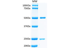 Nplate (Romiplostim) Neutralizing Antibody, Mouse Monoclonal (Clone 5D5-G2)  [MA201N-100 or MA201N-025]