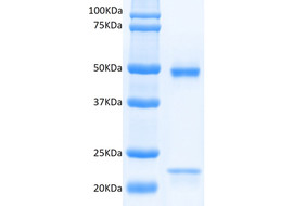 Human Endo180 (D6) Binding Antibody, Mouse Monoclonal  [MA304B-100 or MA304B-025]
