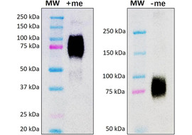 Thrombopoietin (TPO) Neutralizing Antibody, Mouse Monoclonal  [MA211N-100 or MA211N-025]