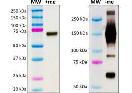 Tumor Necrosis Factor alpha Receptor II (TNFRII) Neutralizing Antibody, Mouse Monoclonal (Clone 8G1-C5)   [MA355N-100 or MA355N-025]