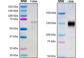 Tumor Necrosis Factor alpha Receptor II (TNFRII) Neutralizing Antibody, Mouse Monoclonal (Clone 12C8-E12)   [MA356N-100 or MA356N-025]