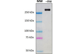 Human metapneumovirus (hMPV) Antibody, Mouse Monoclonal  [MA801B-100 or MA801B-025]