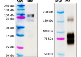 Varicella zoster virus (VZV) gB Antibody, Mouse Monoclonal  [MA651B-100 or MA651B-025]
