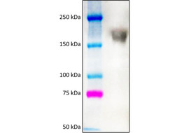 Human parainfluenza virus 2 (PIV2) Antibody, Mouse Monoclonal  [MA750B-100 or MA750B-025]