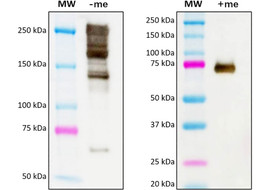 COL1A1 (Human Collagen type I, alpha-1 chain) Antibody, Mouse Monoclonal  [MA321B-100 or MA321B-025]