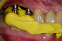 dentaladvantages1.jpg