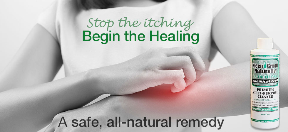 Stop the itching with Kleen Green