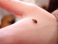 bed-bug-on-hand.jpg