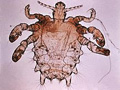 Pubic lice.