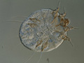 scabies-micoscopic.jpg