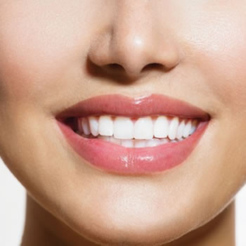 Teeth Whitening Bleach Bright 18 Whiter 30 Mins Le Beau Clinic Spa Perth