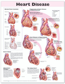 Reference Chart - Heart Disease