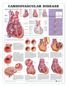 Reference Chart - Cardiovascular Disease