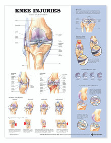 Reference Chart - Knee Injuries