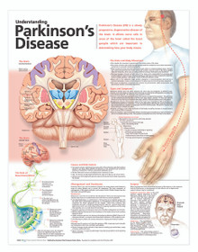 Reference Chart - Understanding Parkinson's Disease
