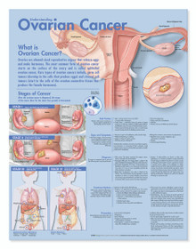 Reference Chart - Understanding Ovarian Cancer