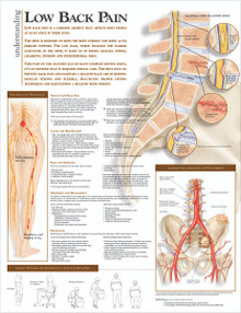 Reference Chart - Understanding Low Back Pain