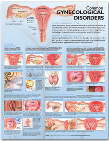 Reference Chart - Common Gynecological Disorders