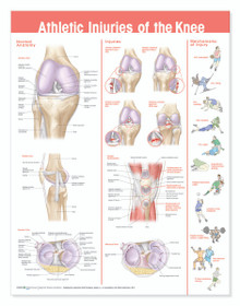 Reference Chart - Athletic Injuries of the Knee