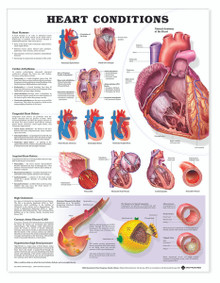 Reference Chart - Heart Conditions