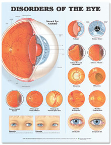 Reference Chart - Disorders of the Eye
