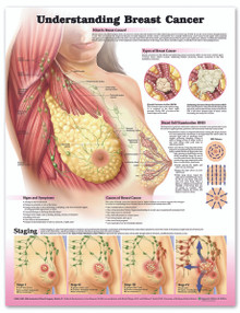 Reference Chart - Understanding Breast Cancer
