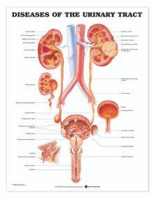 Reference Chart - Diseases of the Urinary Tract
