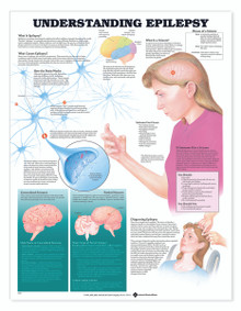 Reference Chart - Understanding Epilepsy