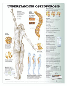 Reference Chart - Understanding Osteoporosis